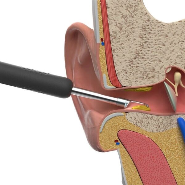 Bebird R1 Ear Cleaner Wax Removal Tool